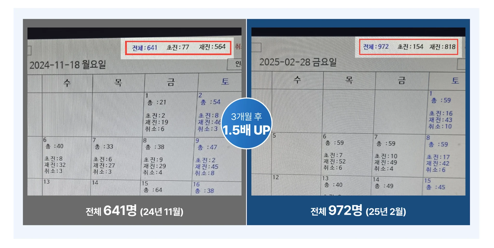 상승기획 마케팅 진행 3개월 전후 신규 환자 1.5배 증가 비교 그래프